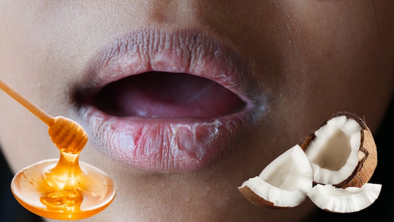 labios-perfectos-verano-recetas-caseras-hidratados