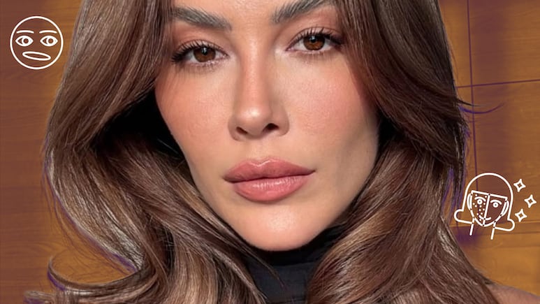 Michelle Salas habla sobre el melasma, una afección en la piel que la afecta.