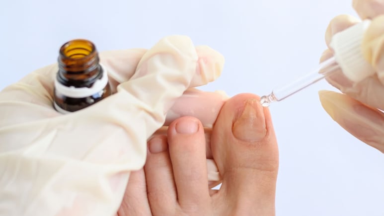 Pies descalzos cuidados sobre arena con ingredientes naturales para remedio casero