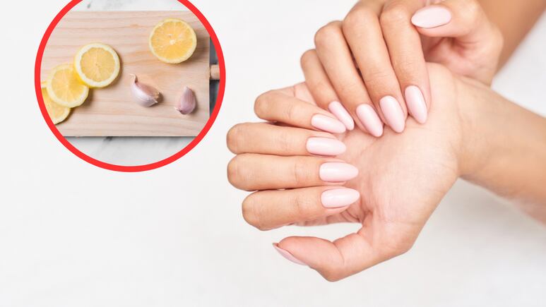 Uñas quebradizas