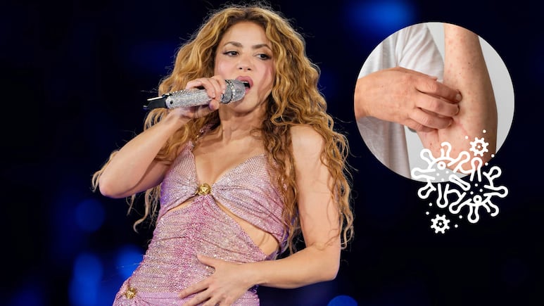 Alertan por posible exposición masiva de sarampión en concierto de Shakira